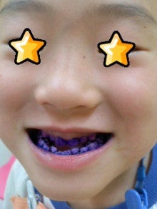 たかてんのブログ-130121_1458~010001.jpg