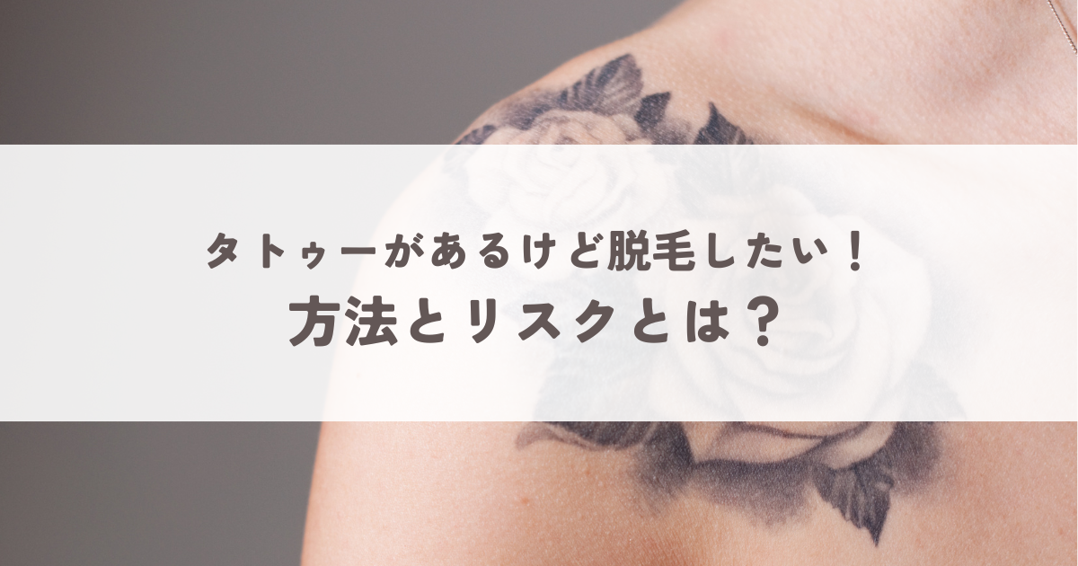 タトゥーがあるけど脱毛したい！方法とリスクとは？ | エステミオレ