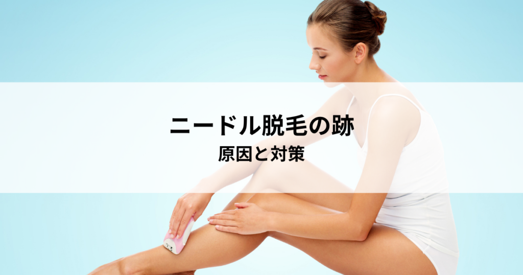 ニードル脱毛の跡の不安を解消！原因と対策を学ぶ