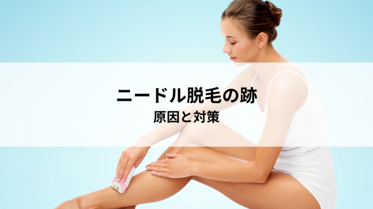 ニードル脱毛の跡の不安を解消！原因と対策を学ぶ