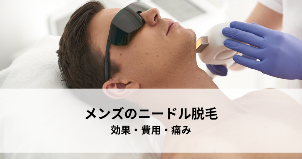 メンズのニードル脱毛とは？効果・費用・痛みを解説