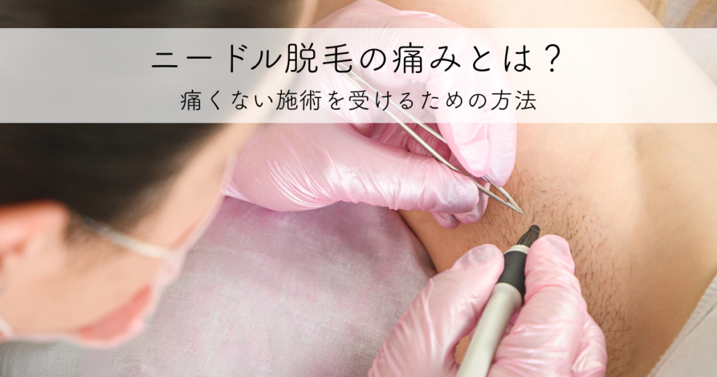 ニードル脱毛の痛みとは？痛くない施術を受けるための方法