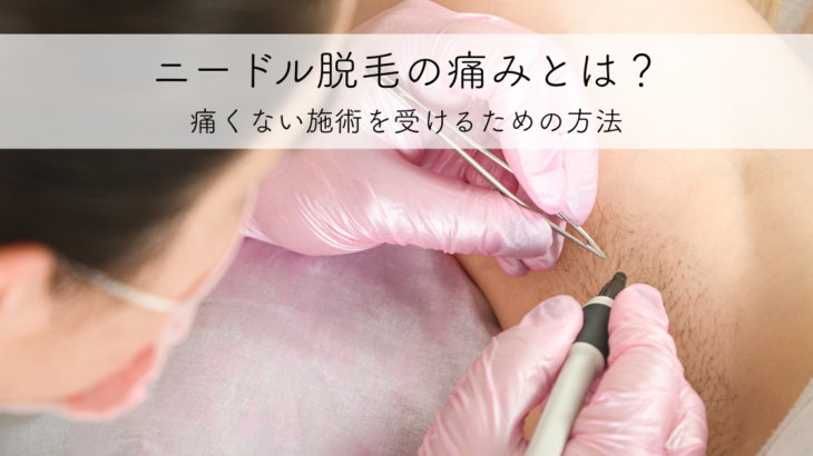 ニードル脱毛の痛みとは？痛くない施術を受けるための方法