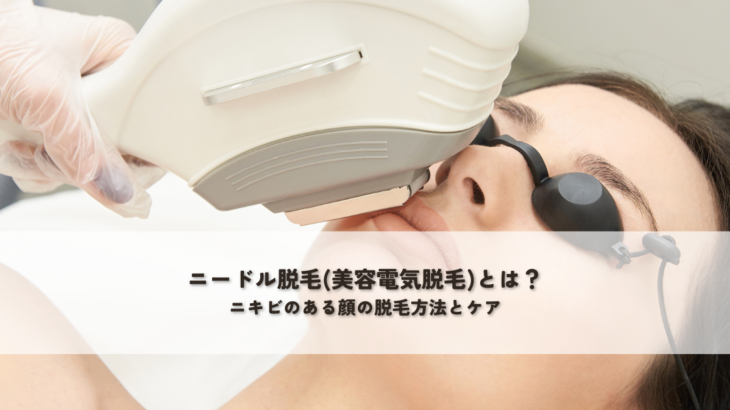 ニードル脱毛(美容電気脱毛)とは？ニキビのある顔の脱毛方法とケア