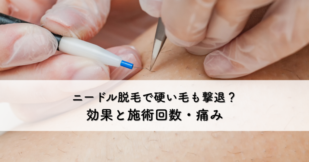 ニードル脱毛で硬い毛も撃退？効果と施術回数・痛みについて解説