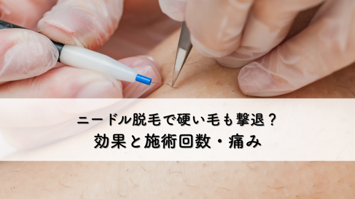 ニードル脱毛で硬い毛も撃退？効果と施術回数・痛みについて解説