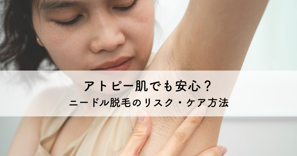 アトピー肌でも安心？ニードル脱毛のリスクとケア方法を解説