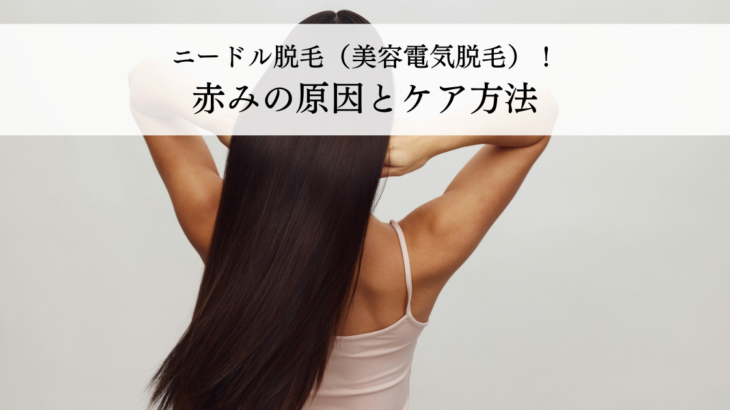 ニードル脱毛（美容電気脱毛）の赤みはいつまで続く？原因とケア方法を解説